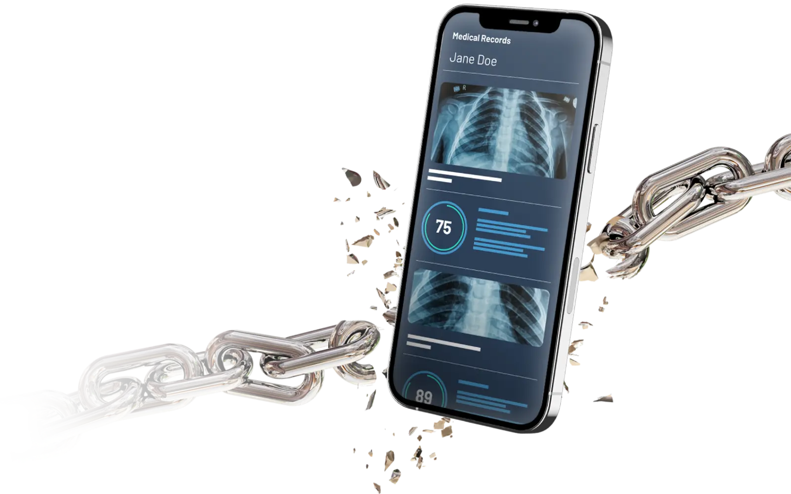 Mobile phone with medical records on screen breaking through thick metallic chains.